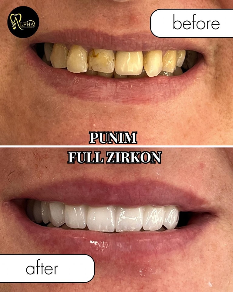 alpha-klinike-dentare-kinostudio-tirane-14