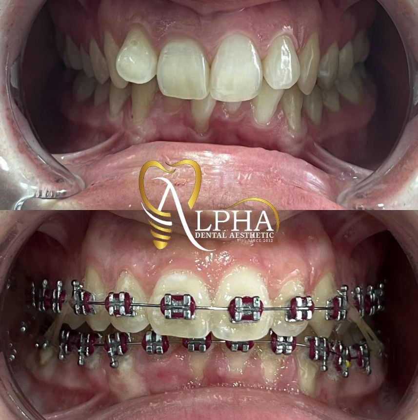 alpha-klinike-dentare-kinostudio-tirane-15