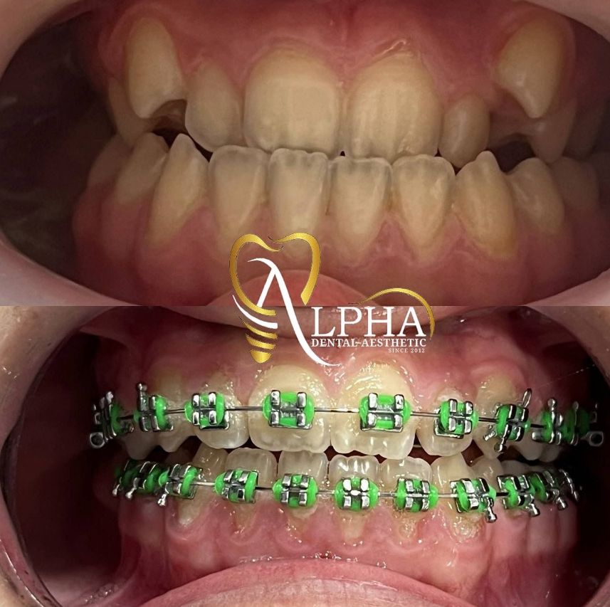 alpha-klinike-dentare-kinostudio-tirane-16