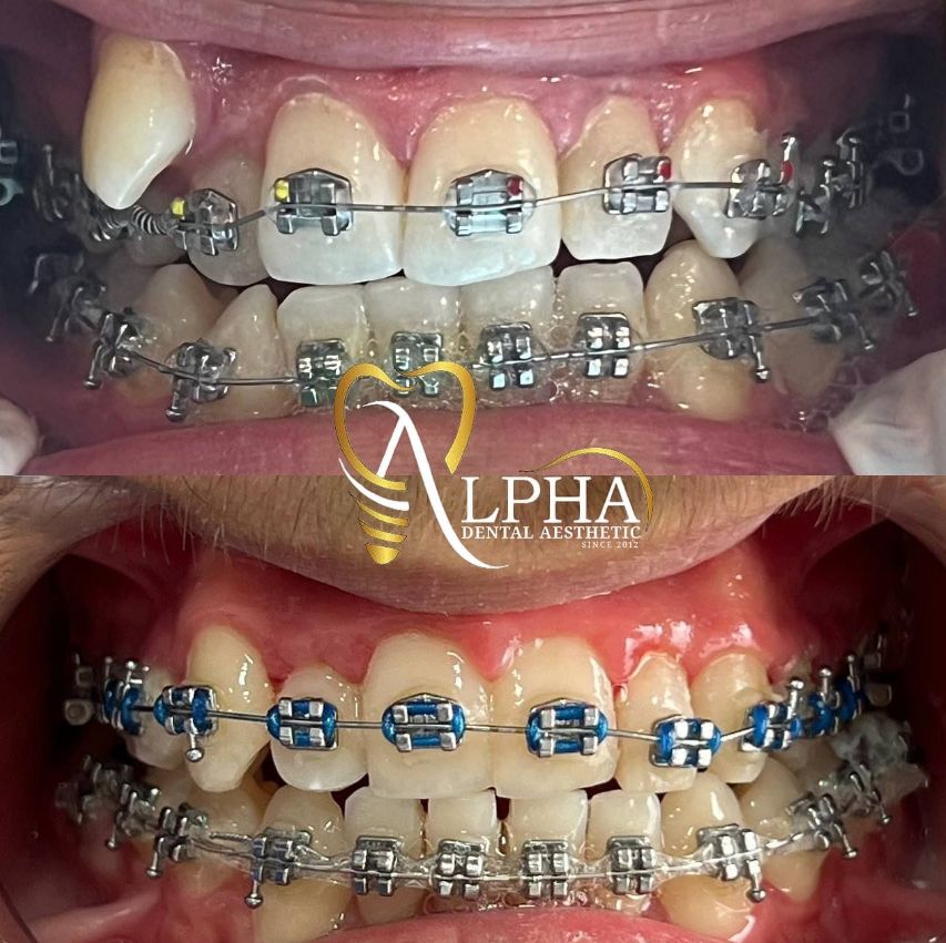 alpha-klinike-dentare-kinostudio-tirane-17