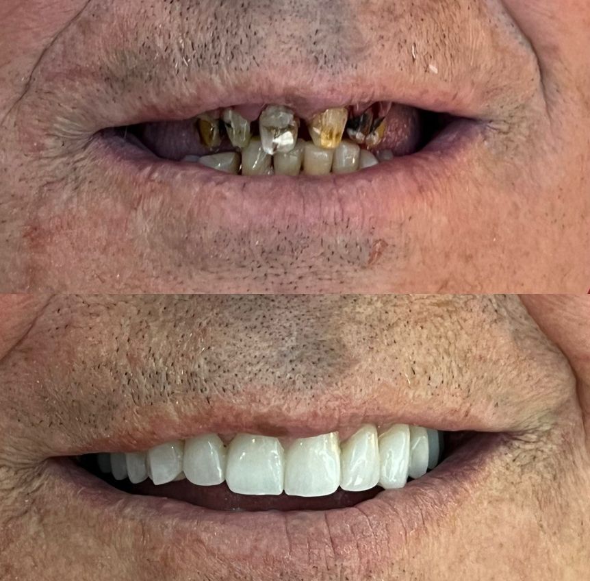 alpha-klinike-dentare-kinostudio-tirane-18