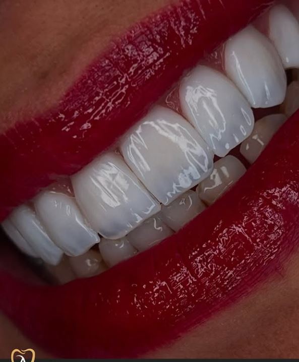 ALPHA-DENTAL-AESTHETIC13