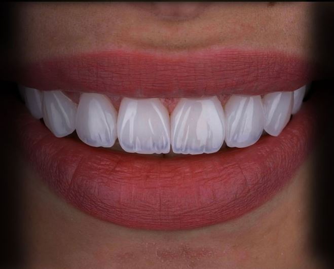 ALPHA-DENTAL-AESTHETIC14