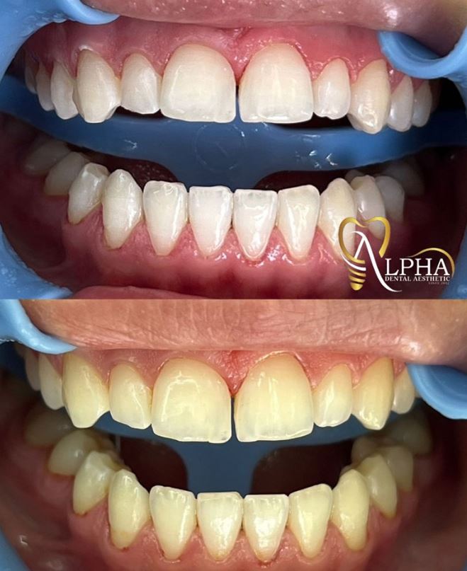 ALPHA-DENTAL-AESTHETIC16