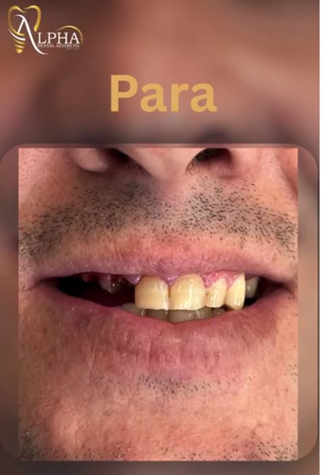 ALPHA-DENTAL-AESTHETIC3