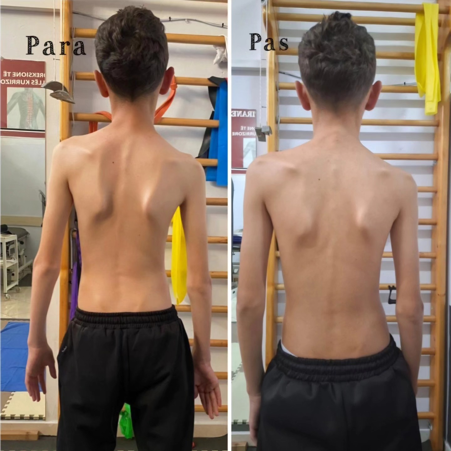 ____________fizioterapi-klinike-fizioterapist-tirane-120