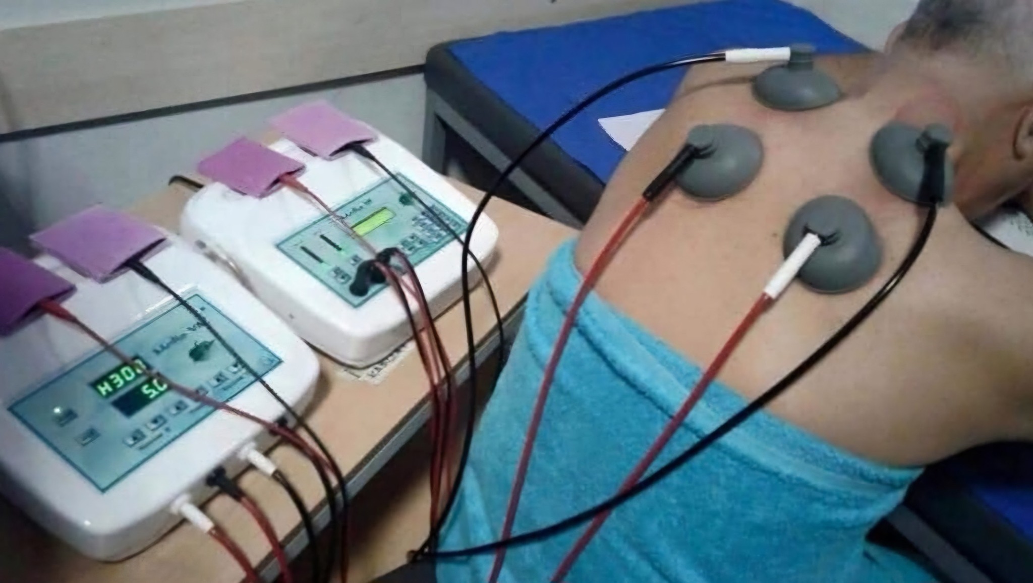 ____________fizioterapi-klinike-fizioterapist-tirane-181