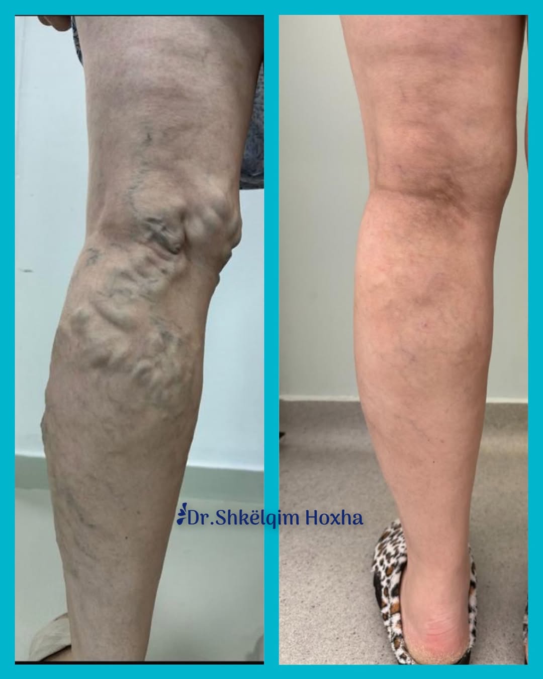 varicet-doktor-per-klinike-1