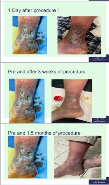 varicet-doktor-per-klinike-15