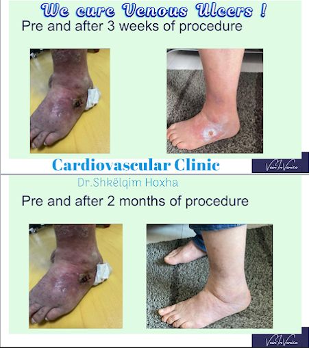 varicet-doktor-per-klinike-16