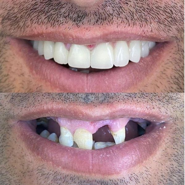 _________________Dentiste-durres-1