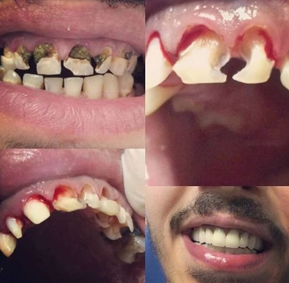 _________________Dentiste-durres-24