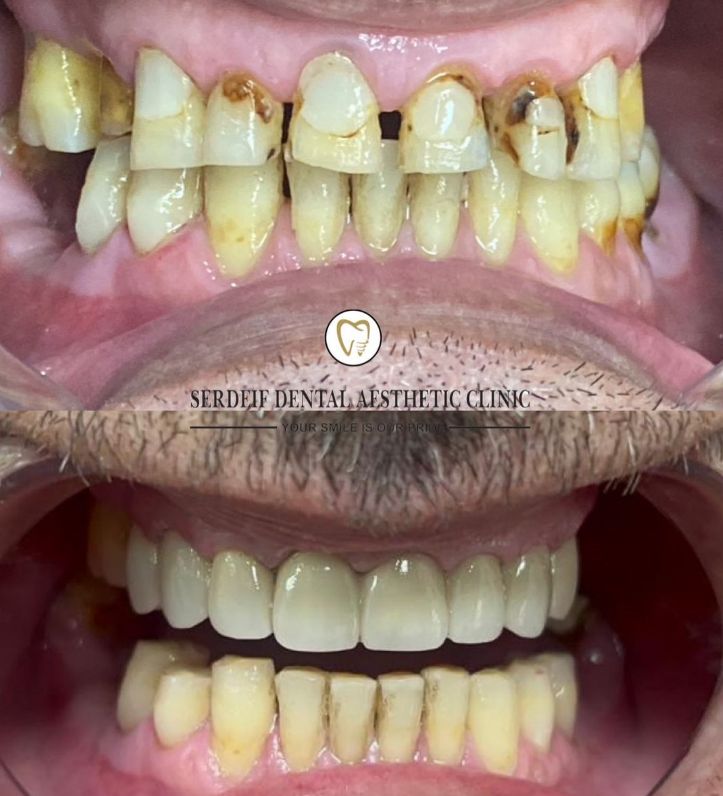 ___dentist-kamez-tirane-1991