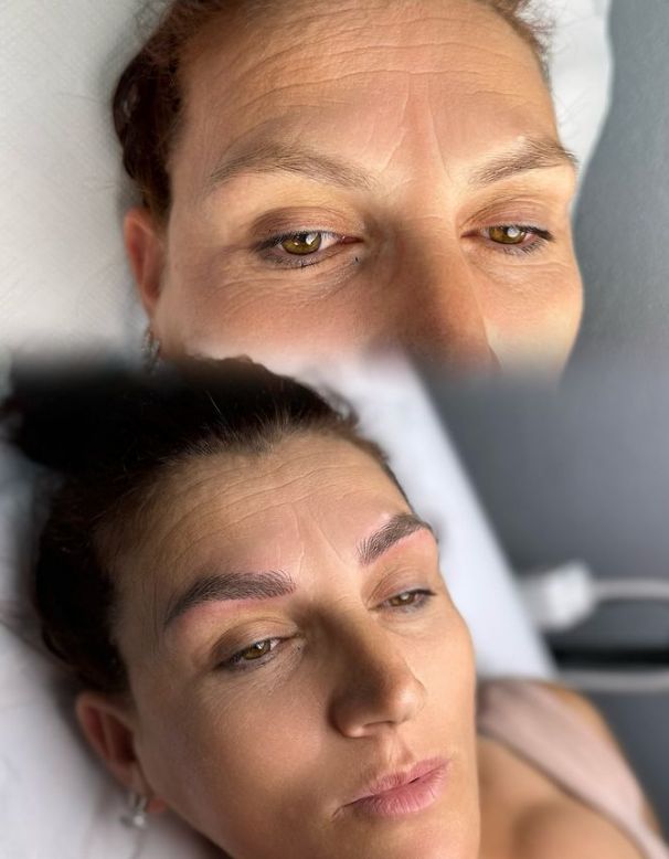 astir-vetulla-microblading-181