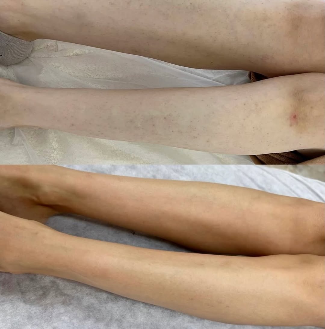 PRODUKTE-LEKURE-DEPILIM-15