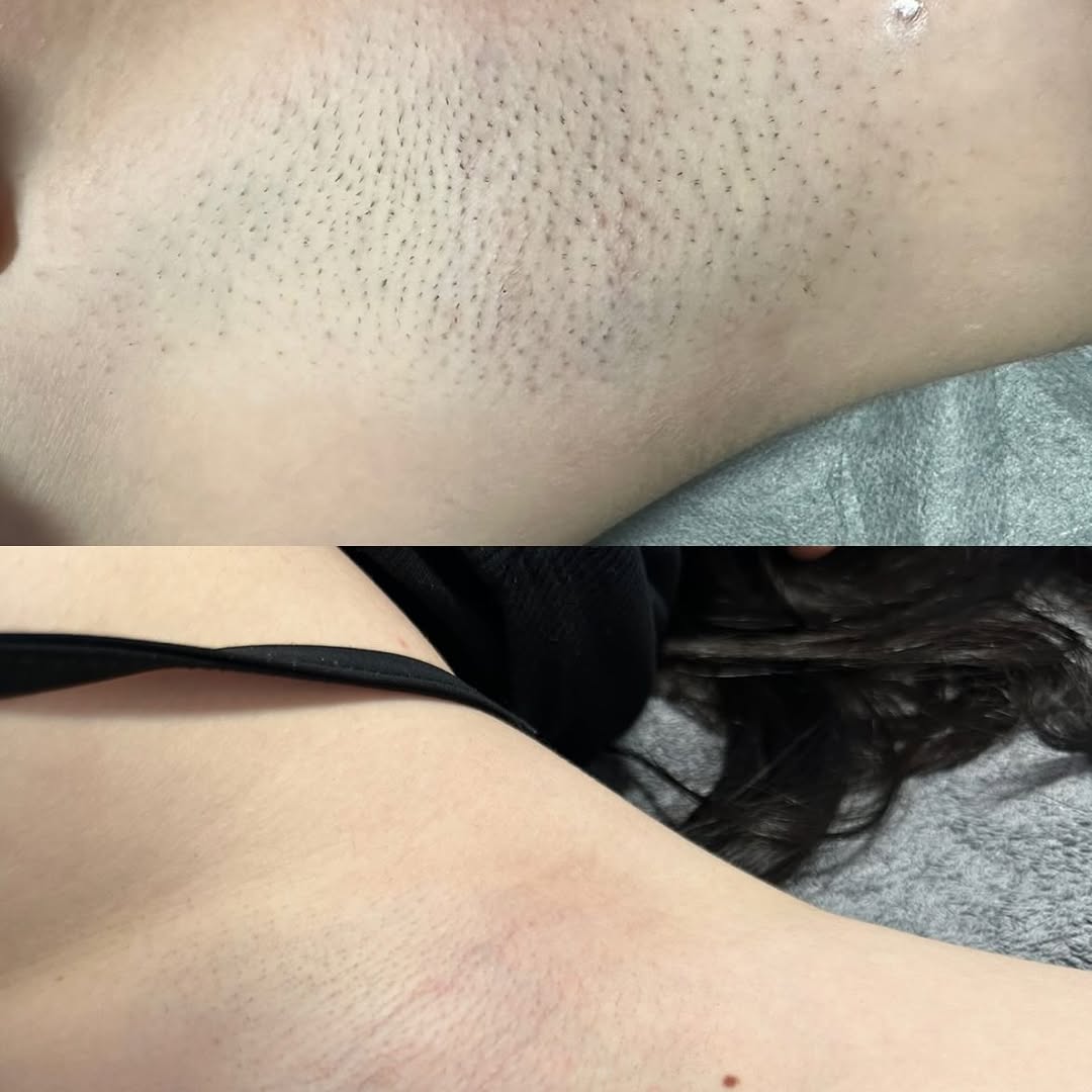 PRODUKTE-LEKURE-DEPILIM-16