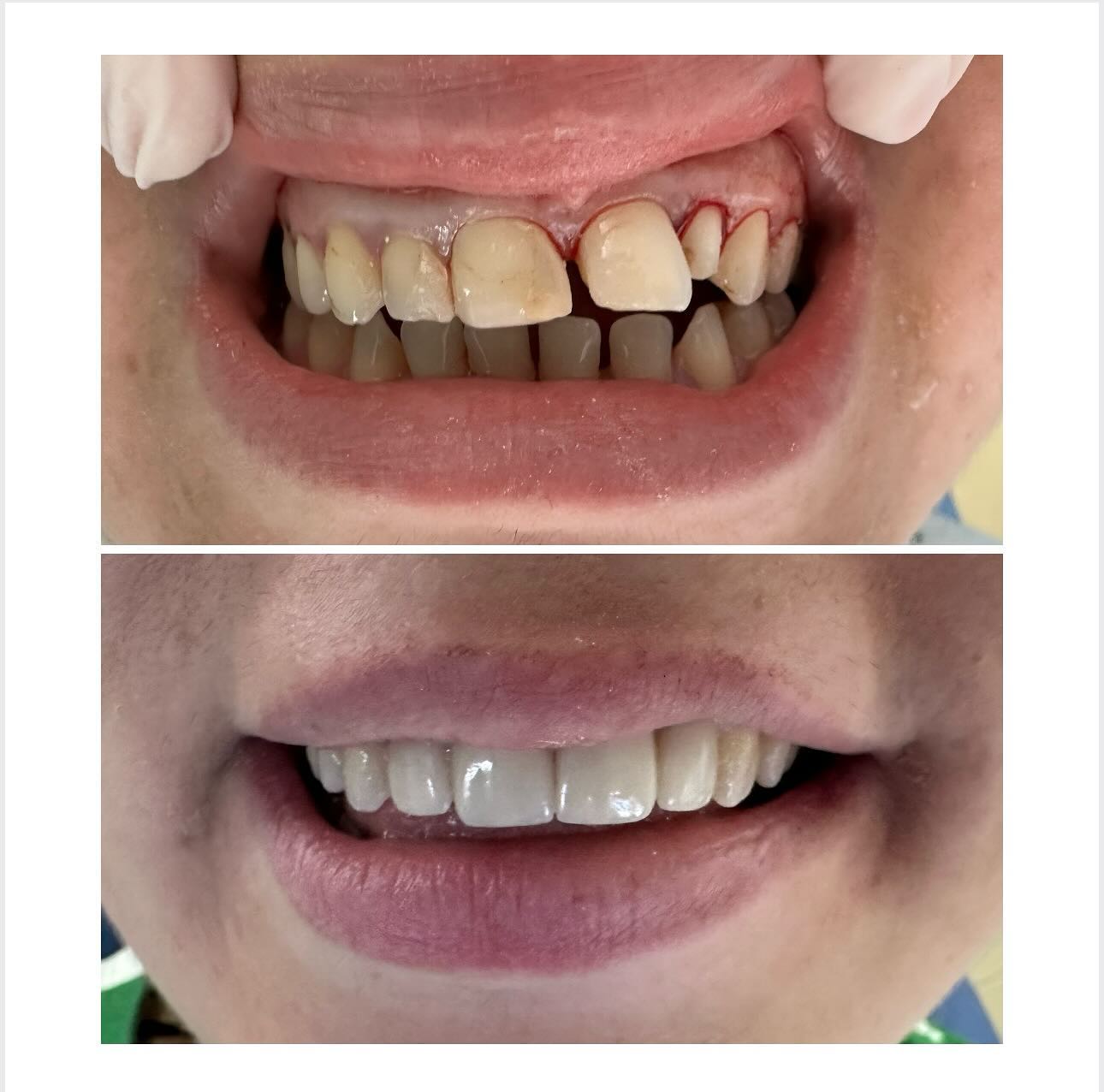 ________ASTIR-KLINIKE-DENTARE-DENTIST-16