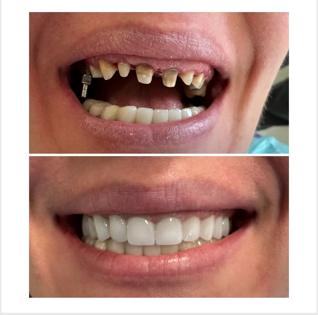 ________ASTIR-KLINIKE-DENTARE-DENTIST-19