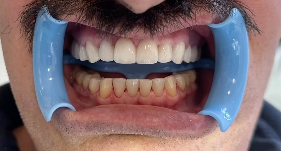 ________ASTIR-KLINIKE-DENTARE-DENTIST-191