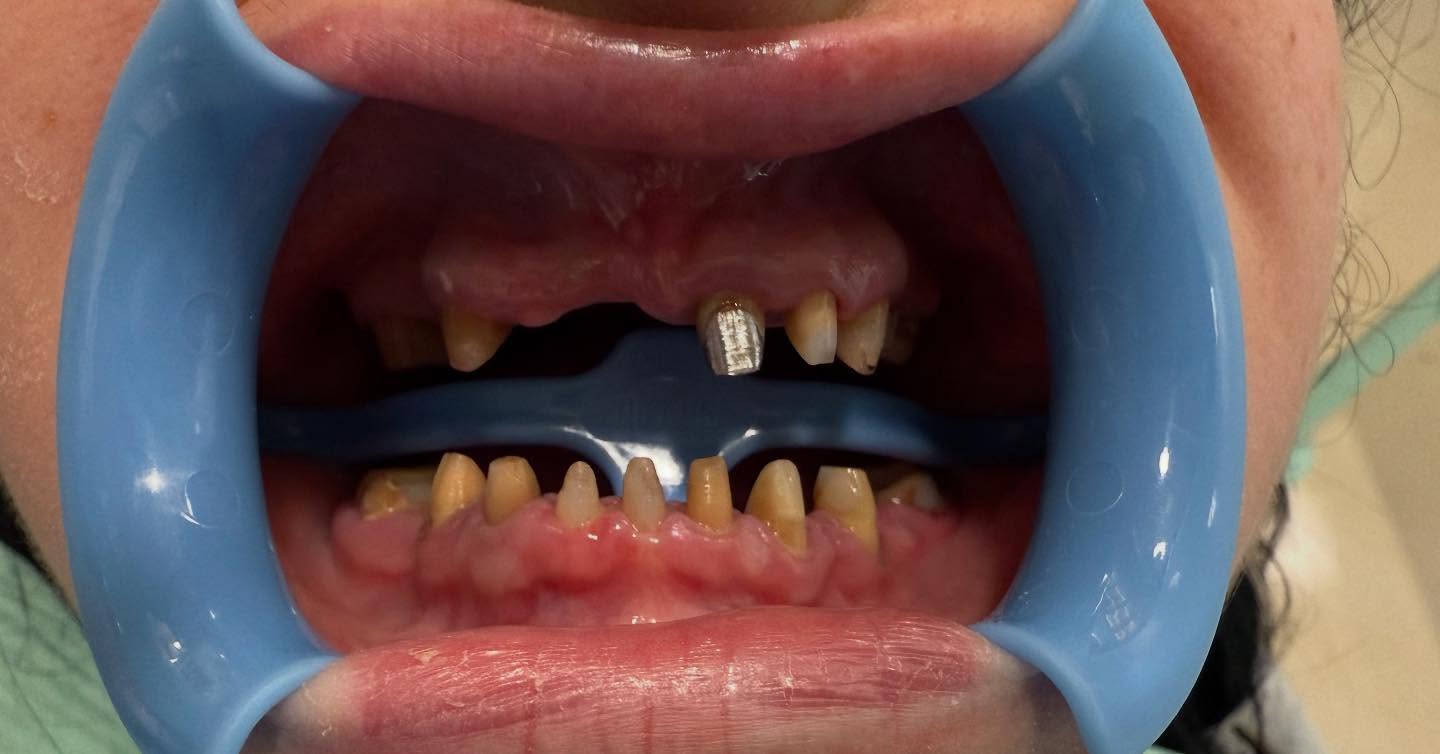 ________ASTIR-KLINIKE-DENTARE-DENTIST-192