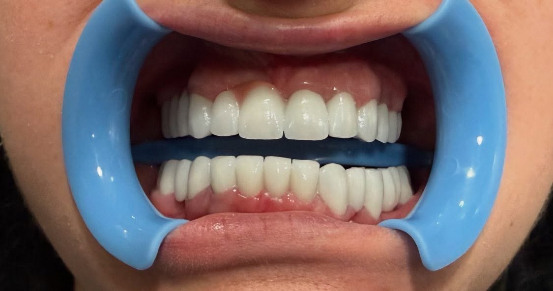 ________ASTIR-KLINIKE-DENTARE-DENTIST-193