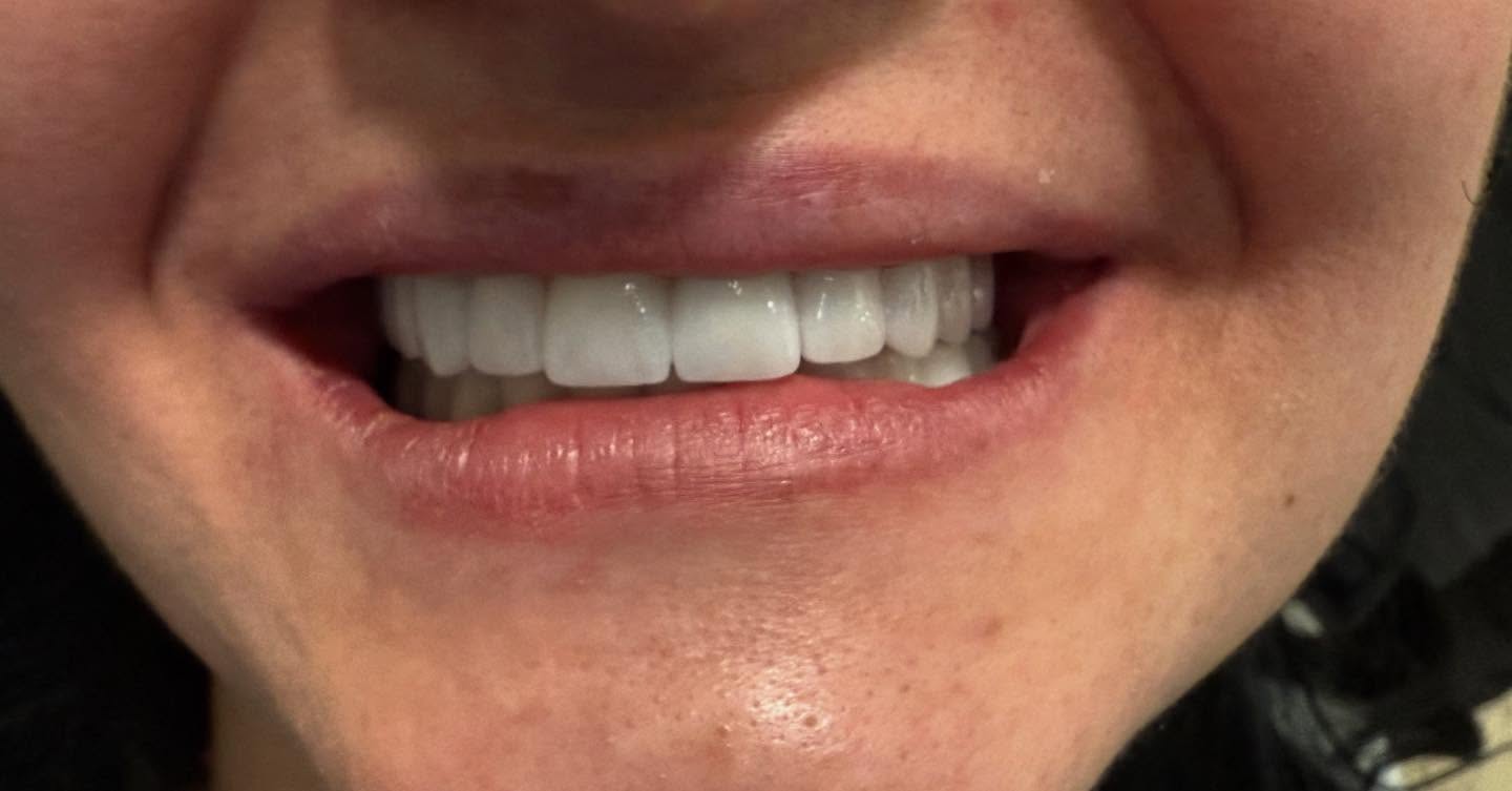 ________ASTIR-KLINIKE-DENTARE-DENTIST-194