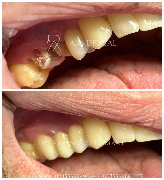 _________________________dentist-klinika-durres-191