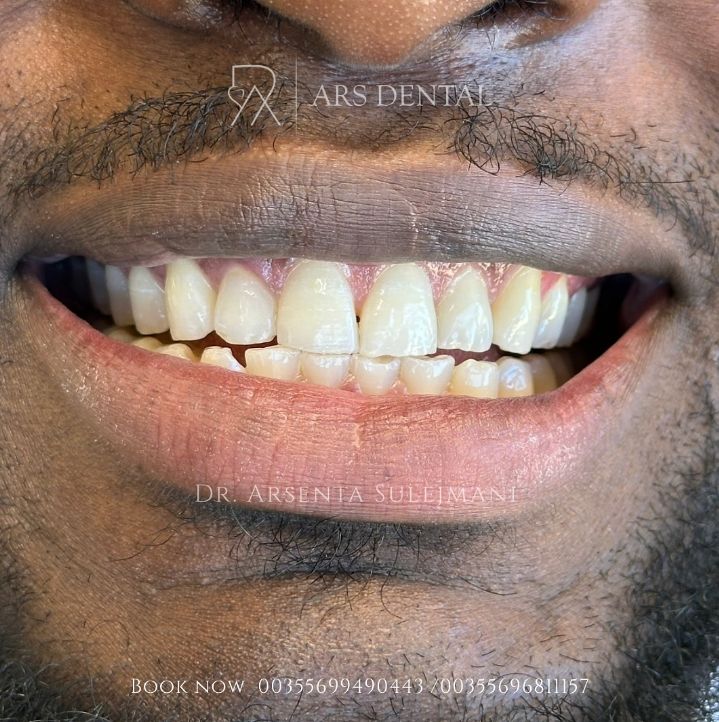 _________________________dentist-klinika-durres-196