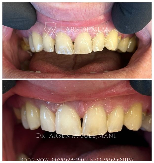 _________________________dentist-klinika-durres-197