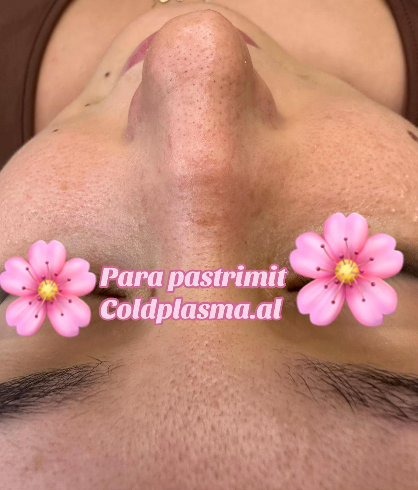 ___trajtim-me-plazem-shkoder-estetike-191