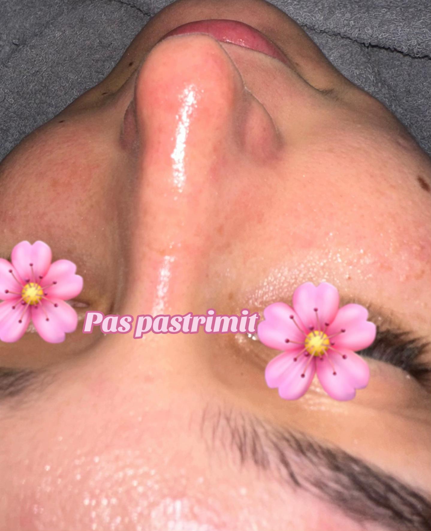 ___trajtim-me-plazem-shkoder-estetike-192