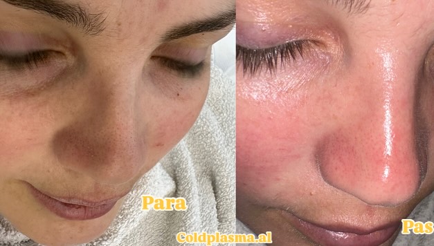 ___trajtim-me-plazem-shkoder-estetike-196