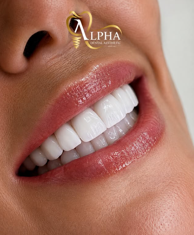 ALPHA DENTAL AESTHETIC – foto 2