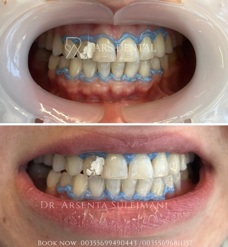 ARS DENTAL - KLINIKE DENTARE PROFESIONALE NE DURRES – foto 3