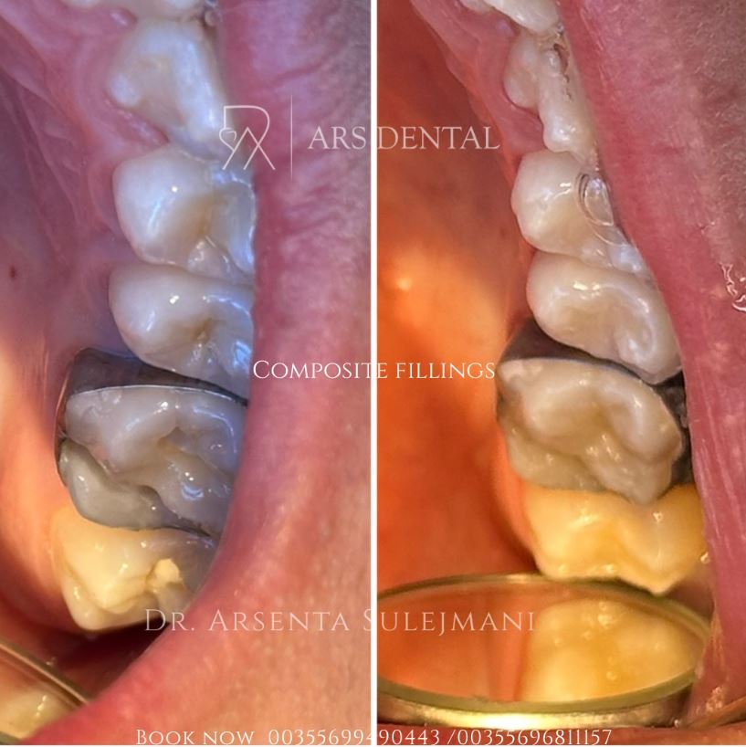 ARS DENTAL - KLINIKE DENTARE PROFESIONALE NE DURRES – foto 4