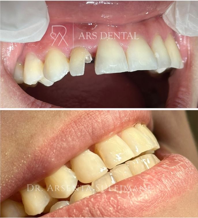 ARS DENTAL - KLINIKE DENTARE PROFESIONALE NE DURRES – foto 2