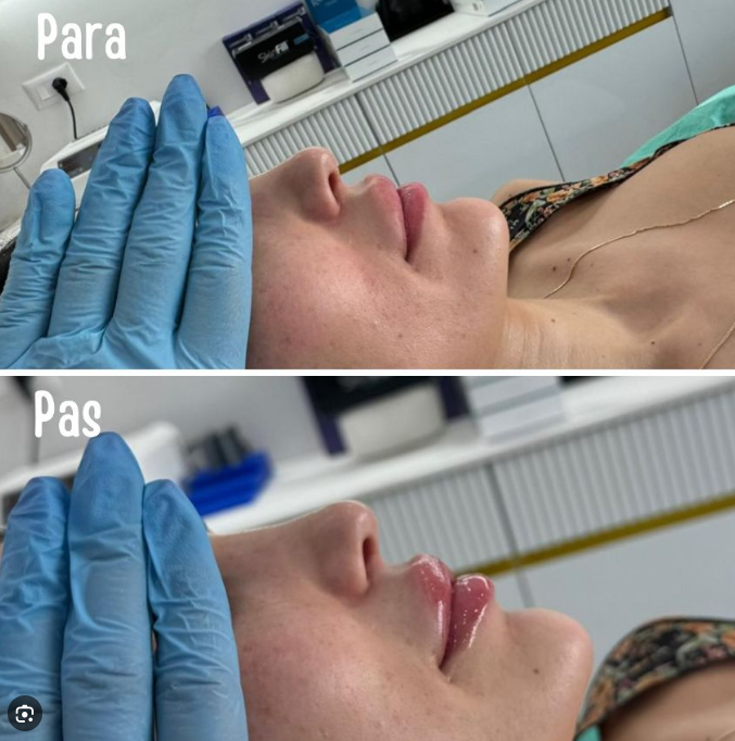 Klinika Dermoestetike Unik – Dr. Denisa Zhegu – foto 2