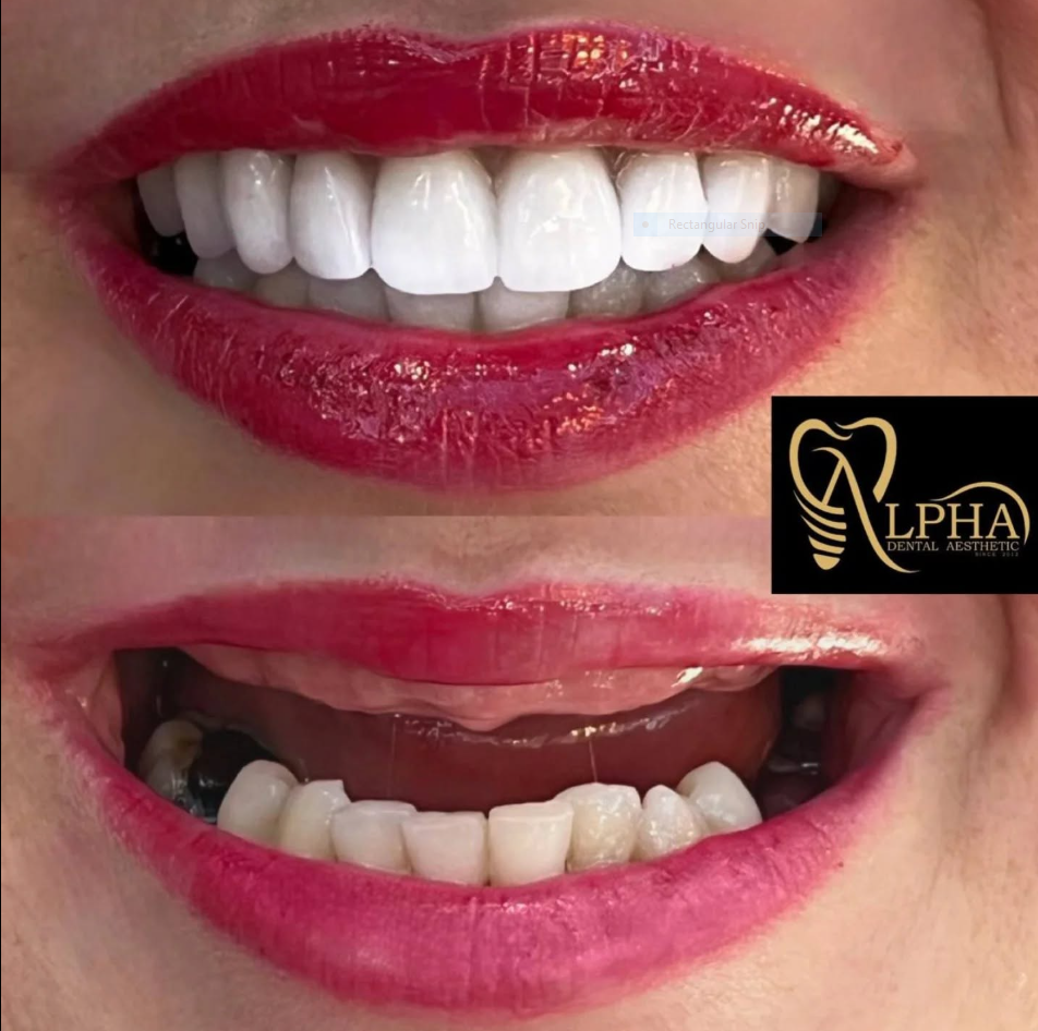 ALPHA DENTAL AESTHETIC, DR. ESMERALDA BACI - TIRANË – foto 4