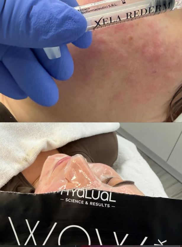SEVEA AESTHETIC CLINIC - QENDER ESTETIKE MODERNE NE TIRANE – foto 3
